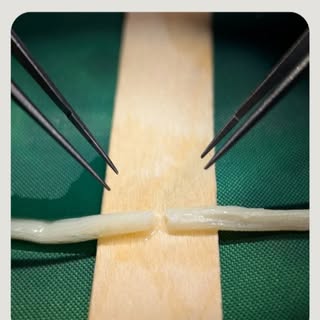 Nerve injuries from dental procedures don't have to be permanent. While they can devastate your qual
