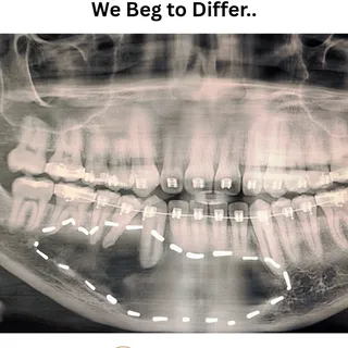 When a lesion's behavior and x-ray doesn't match the previous diagnosis, a redo biopsy is advised. 

