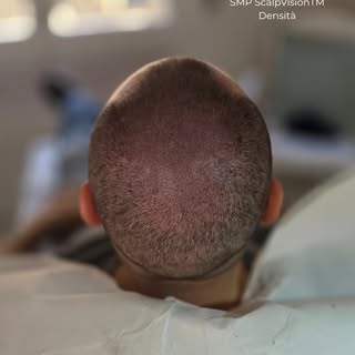 📲 Caption Instagram – Effetto Densità

“Pensavo al trapianto da anni… poi ho scoperto che c’era una
