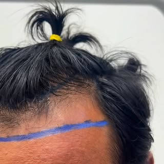 6 meses que mudam não só o cabelo e as sobrancelhas — mas a forma de se enxergar no espelho.

Result