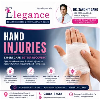 Hands do everything for us—until an injury stops us in our tracks. 🖐️⚡ 

Here’s what you need to kn