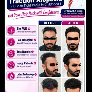 Looking for a Best Place for Hair Transplant.

Visit Elegance Hair Transplant Clinic 

Book your app