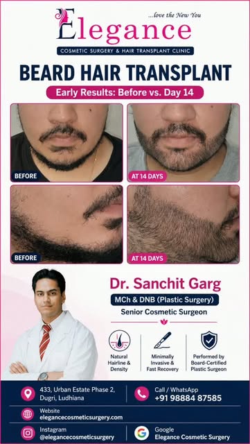 ​Tired of patchy growth or an uneven beard line? 

A sharp, well-defined beard is all about precisio