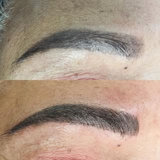 Top: Former microblading and shading combination from another provider. Microblading strokes faded a