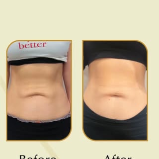 Build muscle. Burn fat. Feel stronger.

Discover Emsculpt Neo at Ihya House of Aesthetics, a non-inv