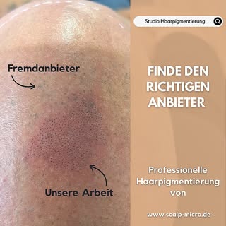 Informiere dich genau über die Techniken und das Equipment deines Anbieters für die Haarpigmentierun