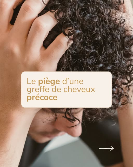 À quel âge consulter pour une greffe de cheveux chez l'homme ? 👨⁠
⁠
Il n'y a pas d'âge idéal, mais 