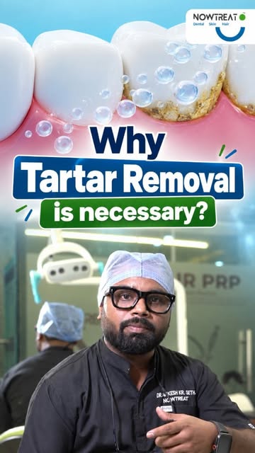 Why is tartar removal important for healthy teeth and gums?
Dr. Ankesh Seth, Dentist, explains how p