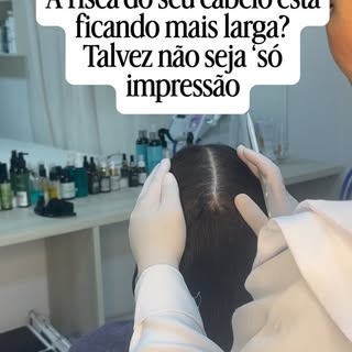 Você acha que alopecia androgenética é simplesmente “cair cabelo”? Esse é um dos maiores enganos.

E