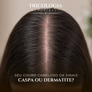 Coceira, descamação, vermelhidão e oleosidade excessiva podem indicar que algo não está bem com a sa