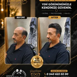 Siz hala eski görünümünüze kavuşmak için hayel mi kuruyorsunuz... 
Hiç bir şey için geç değil siz ha