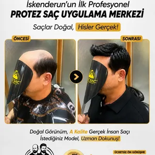 Hayellerinize bir adım kadar uzağız...
Seyrek saçlara çözüm KONFOR PROTEZ SAÇ MERKEZİ...

#hatay 
#i