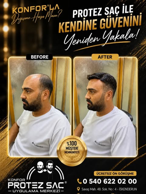 🏆 Yeni bir hikaye 
🥇 Yeni bir tarz 
🥇 Yeni bir sen

#iskenderunçarşı 
#iskenderun 
#iskenderunsah