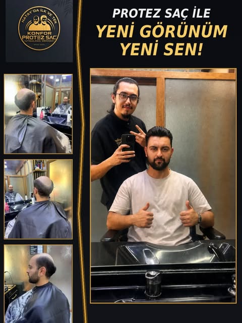 Yeni bir sen için hazır mısın?
Ozaman adres KONFOR PROTEZ SAÇ MERKEZİ 

#iskenderunçarşı 
#iskenderu