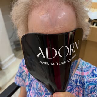 This topper transformation takes the prize today ! Her alopecia is beautifully concealed, creating a