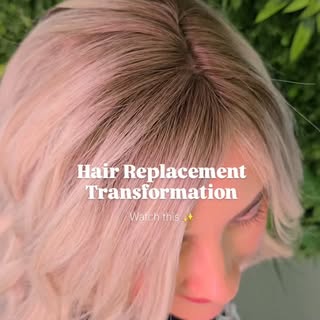 💫 Fitting our stunning Enhanced Mesh System 💜 Our bespoke solution for hair replacement, hair thin