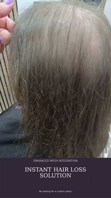 Instant hair loss solution. No waiting for a custom piece. ✨

Our Enhanced Mesh Integration systems 