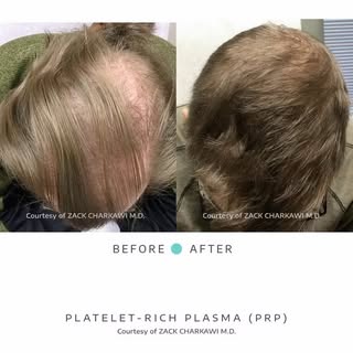 Here’s what the science tells us:

• Support activity around weakened hair follicles
• Improve blood