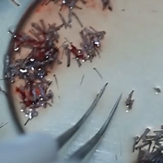 Preservation and preparation 

#skinaaclinic #viral #skincare #happy #hairextensions