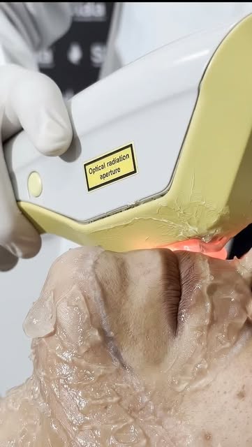 Laser hair removal @skinaa.clinic 

#healthylifestyle #bodyart #hair #happiness