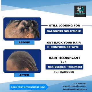 Still looking for a baldness solution? 👀
It’s time to stop hiding and start restoring!
Get back you