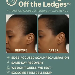 Get Your Edges Off the Ledges™ ✨
Struggling with traction alopecia? You don’t have to anymore. Our e