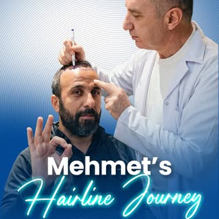 Where science meets aesthetic excellence. ✨ In Mehmet’s transformation journey, we designed a natura
