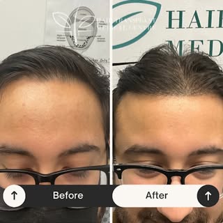 Hair loss? You’re not alone. Let us help you! ⭐️