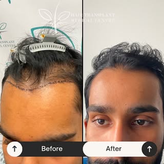 New hair. New confidence. ✨
This is what a life-changing transformation looks like. 

Contact us for