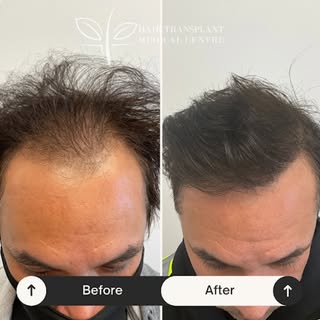 Visible results? You know where to come. 💫 

Contact us for a free consultation at +1-905-272-0190!