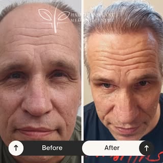 12 months of progress. A lifetime of confidence. ✨ 

📞 Contact us on +1-905-272-0190 and schedule a