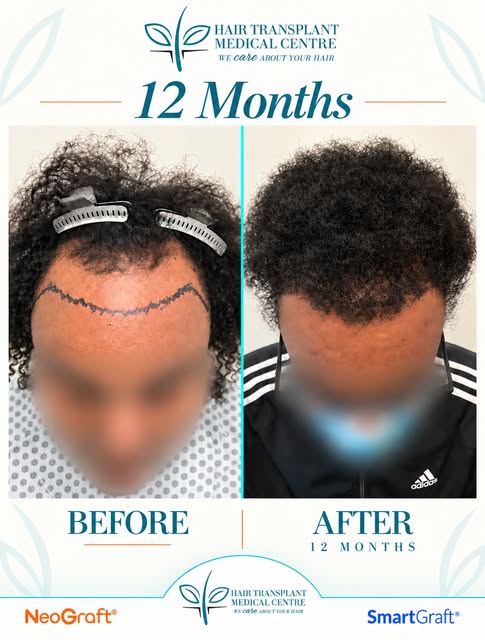 12 months of progress. A lifetime of confidence. ✨ 

📞 Contact us on +1-905-272-0190 and schedule a