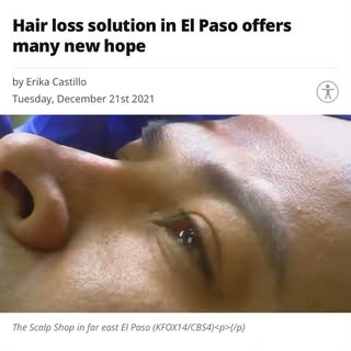 It was an honor to come out on my hometowns Local News. Hair loss is REAL and there is a 100% effect
