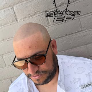 This isn’t just a new hairline… it’s a younger version of yourself.

These results don’t just restor