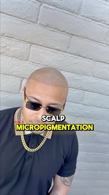 Hair loss can change the way you see yourself. SMP can change it back. 💯

Scalp Micropigmentation i