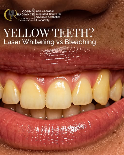 Tired of hiding your smile because of yellow teeth? 🦷✨ Let’s break down the truth about DIY bleachi