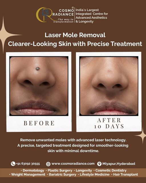 Transform your skin with precision. ✨ Witness a real 10-day transformation using our advanced Laser 