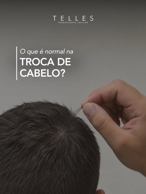 Encontrar alguns fios no banho ou na escova não significa, por si só, que existe um problema. O cour