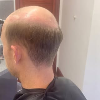 NEW HAIR DAY 😍

Male Patterned Baldness will affect 85% of men by the time they are 50! A lot of ou