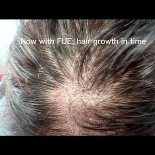 #lasvegashairrestoration