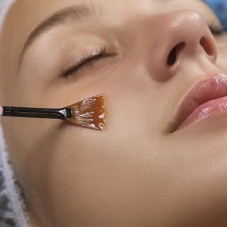 ✨ Reveal fresh, glowing skin with a chemical peel! Here’s why you need it. 🔬💆‍♀️ #glowingskin #che