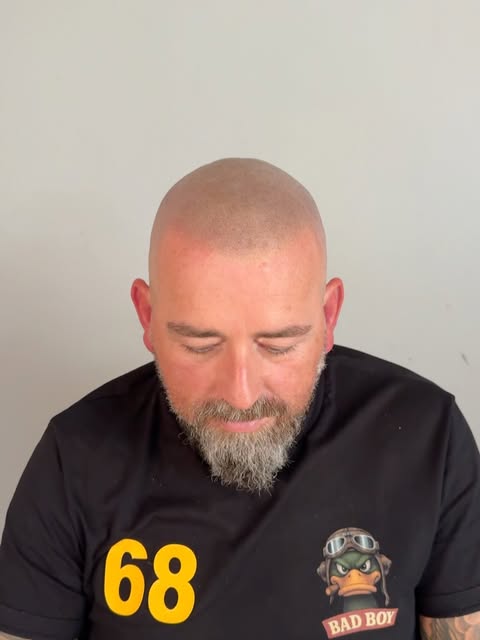 Video y fotos de un nuevo cambio. 
Años rapado y acostumbradisimo a llevar una gran frente. 
Decidió