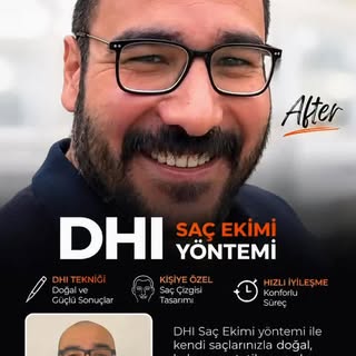 DHI Saç Ekimi ile Doğal Görünüm 🌿

DHI (Direct Hair Implantation) tekniği, saç köklerinin özel Choi