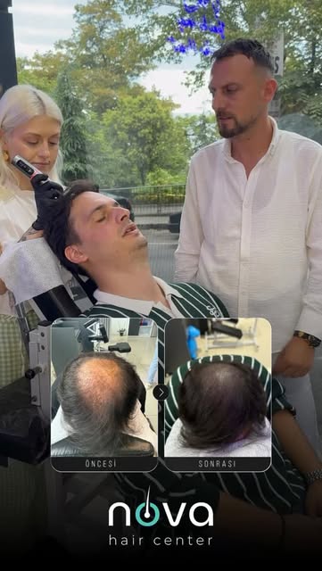 Saç dökülmesi, seyrek bölgeler ve saç ekimi sonrası kapanmayan alanlar artık kaderiniz olmak zorunda