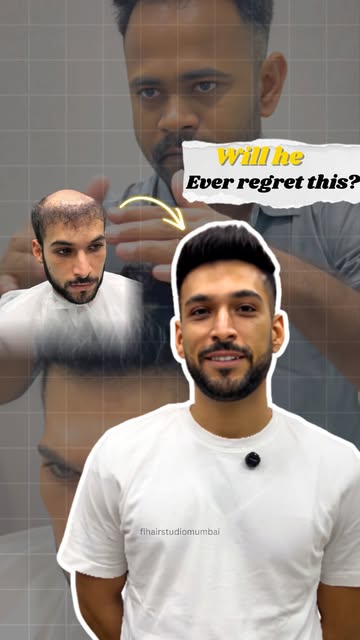 Change how you feel about yourself.

Hair loss isn’t just about appearance it affects your confidenc