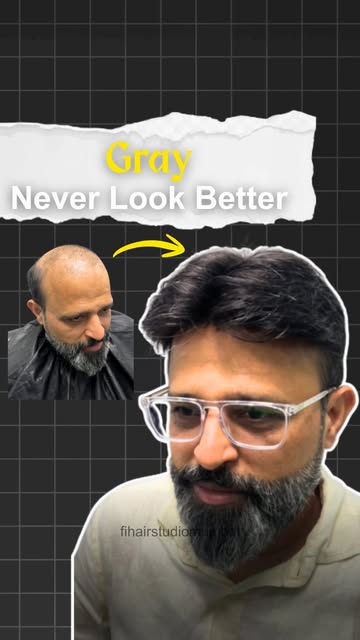 Hair Loss Doesn’t Have to Define You. 💯

Get your confidence back with our Natural-Looking Hair Pat