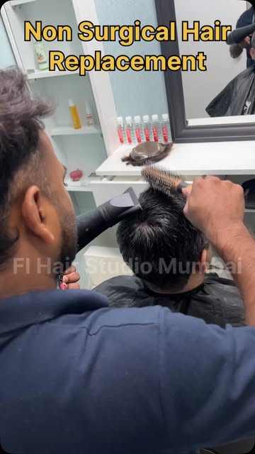 Give me your feedback  hair loss,  problem and solution From Hair Loss to a Whole New You! 🔥

A ful