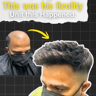 Hair loss? Your confidence doesn’t have to go with it. ✨

See the transformation with a natural-look