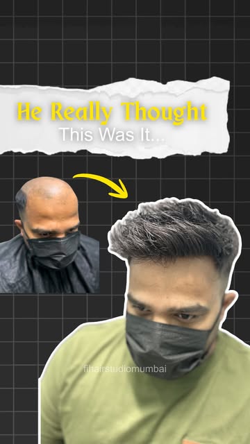 Stop Scrolling

Hair loss changed your look? Change it back. 🔥

A natural-looking hair transformati