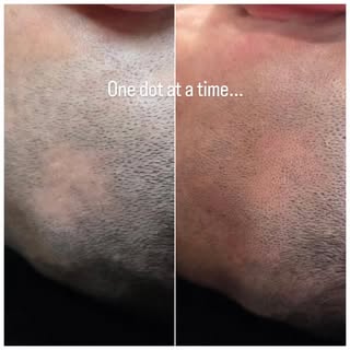 One dot at a time. 

Something I have been doing for the past 8 years. 
Seeing clients confidence co